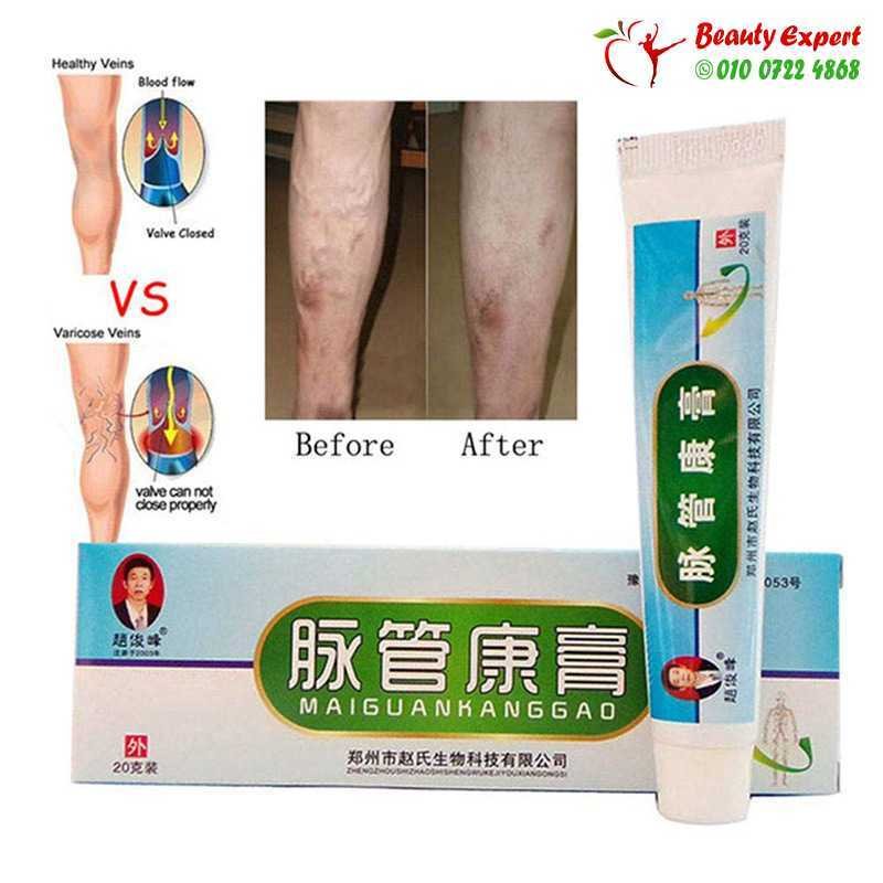 Varicose Veins Cream image 3